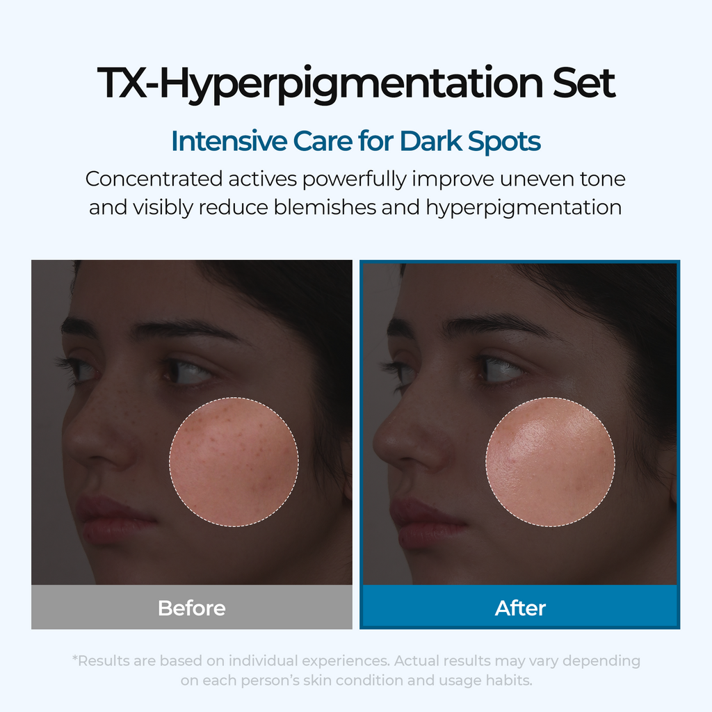 Dark Spot & Uneven Tone Peel Shot TX Duo