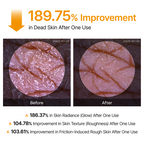 Peel Shot Glow Rice Ampoule Duo & Kojic Acid Duo